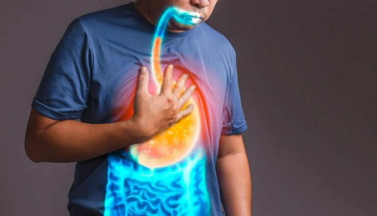 Persoon met brandend maagzuur